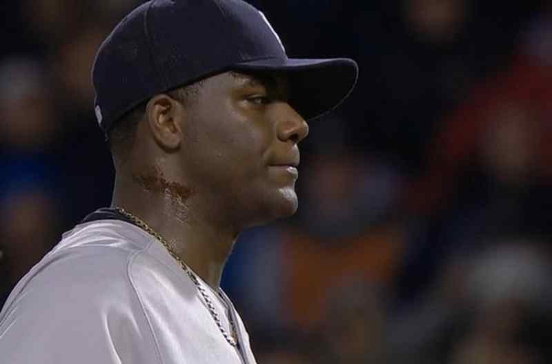 Was ist Kiefernteer und warum ist es im Baseball illegal?